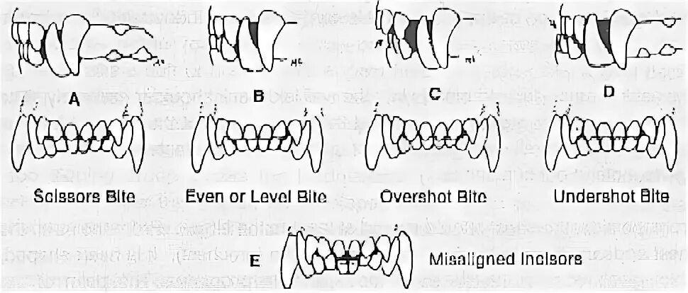 Bite формы