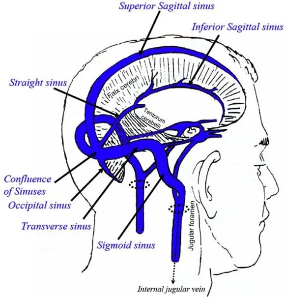 Отток крови от головного мозга. Поперечный синус твердой мозговой оболочки. Синусы твердой мозговой оболочки схема. Синусы твердой оболочки головного мозга. Схема венозных синусов твердой мозговой оболочки.