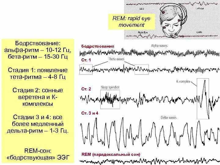 Ээг бодрствования. ЭЭГ Альфа бета тета Дельта ритмы. Веретена сна на ЭЭГ. Фазы сна Альфа бета тета. Стадии сна ритмы ЭЭГ.