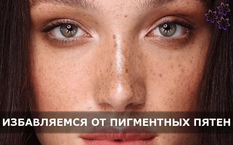 Пигментные пятна купить. Избавление от пигментных пятен. Пигментные пятна избавление.