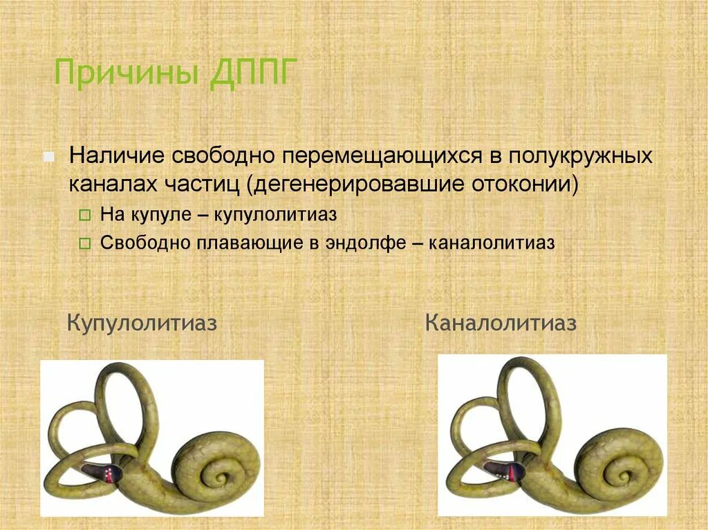 Доброкачественное позиционное головокружение лечение. Дппг внутреннее ухо. дппг заднего полукружного канала. дппг доброкачественное пароксизмальное. дппг горизонтального полукружного канала.