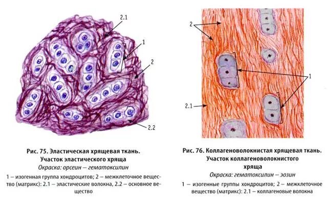 Хрящевая соединительная ткань строение. Строение хрящевой ткани надхрящница. Хрящевая ткань строение ткани. Хрящевая соединительная ткань схема. Хрящевая ткань животного