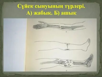 Ұзын үлкен сиқыр