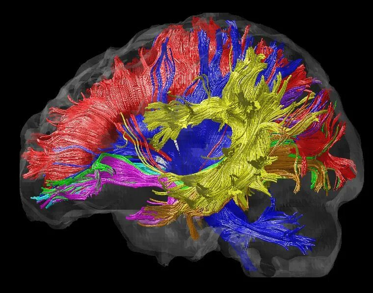 Диффузное поле. Магнитно резонансная трактография. Diffusion Tensor Imaging (DTI). Трактография мрт. Трактография головного мозга.