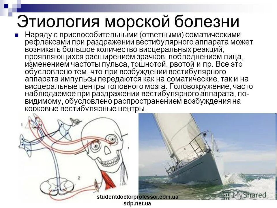 Страдаете морской болезни. Морская болезнь. Информация про морскую болезнь. Морская болезнь причины. Морская и воздушная болезнь.