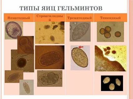 Размеры яиц глистов