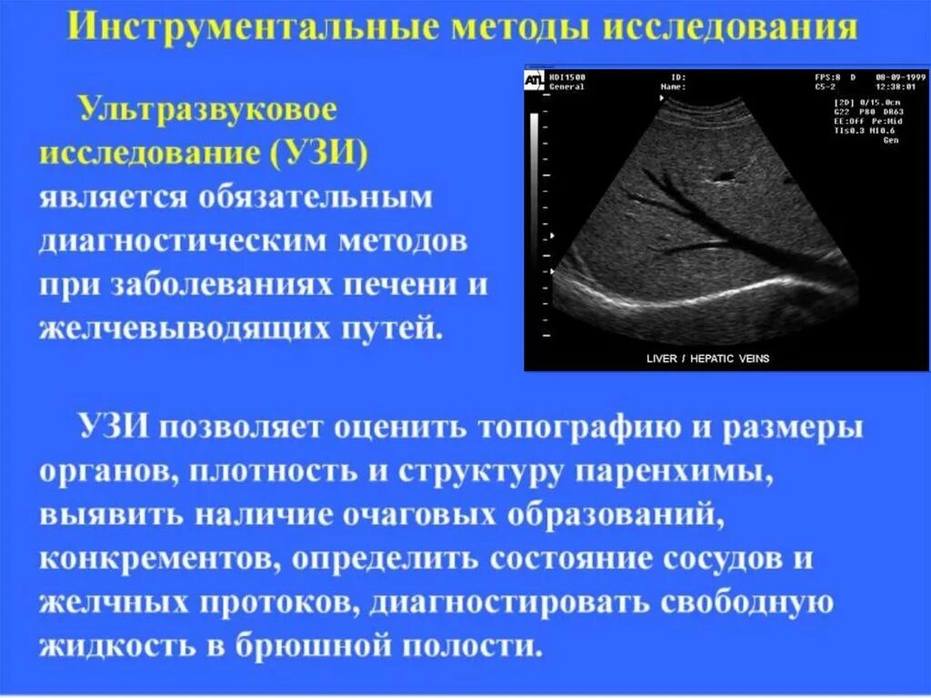 Печень больная диагноз. Инструментальные методы исследования печени. Инструментальные методы исследования печени и желчевыводящих путей. Инструментальные методы исследования при заболеваниях печени. Методы инструментальной диагностики печени.