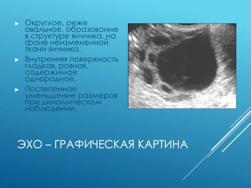 Жидкостные образования яичников. Кистозная структура яичника. Жидкостное образование в яичнике что это.