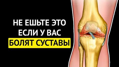 Вред суставом