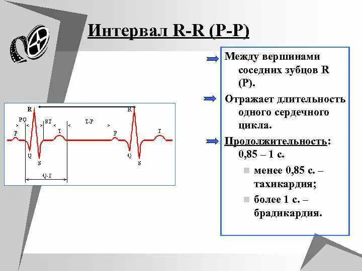 Интервал r r в ЭКГ. Интервалы r-r на ЭКГ отражает. Интервал рр на ЭКГ норма. Укорочение интервала RR на ЭКГ.