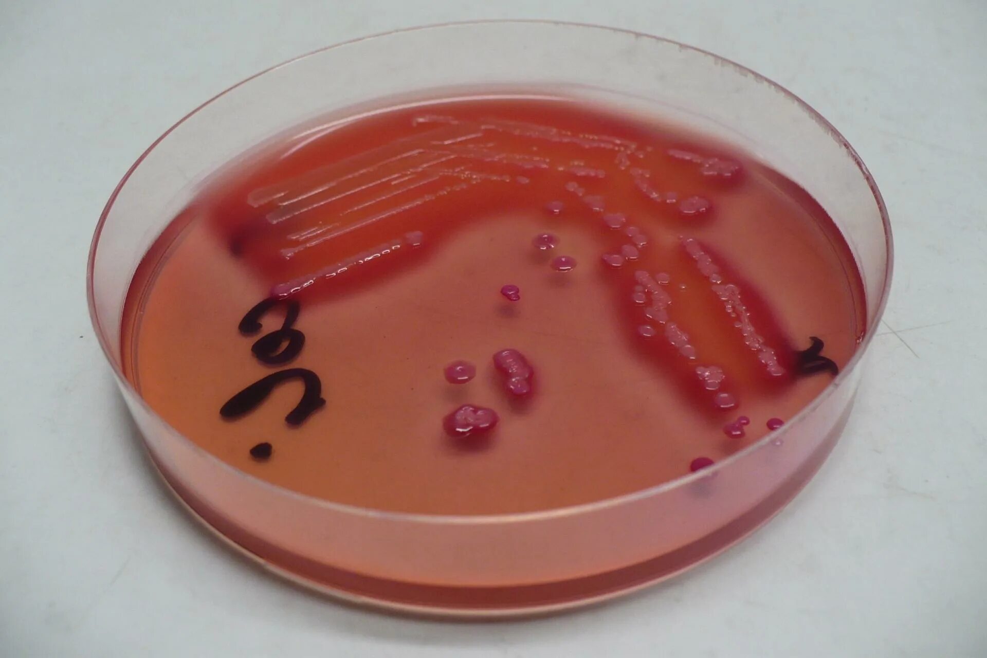 Кишечная палочка отзывы. Кишечная палочка Escherichia coli. Штамм бактерий Escherichia coli. Эшерихия кишечная палочка. Эшерихия коли микробиология.