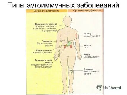 Аутоиммунное заболевание ног
