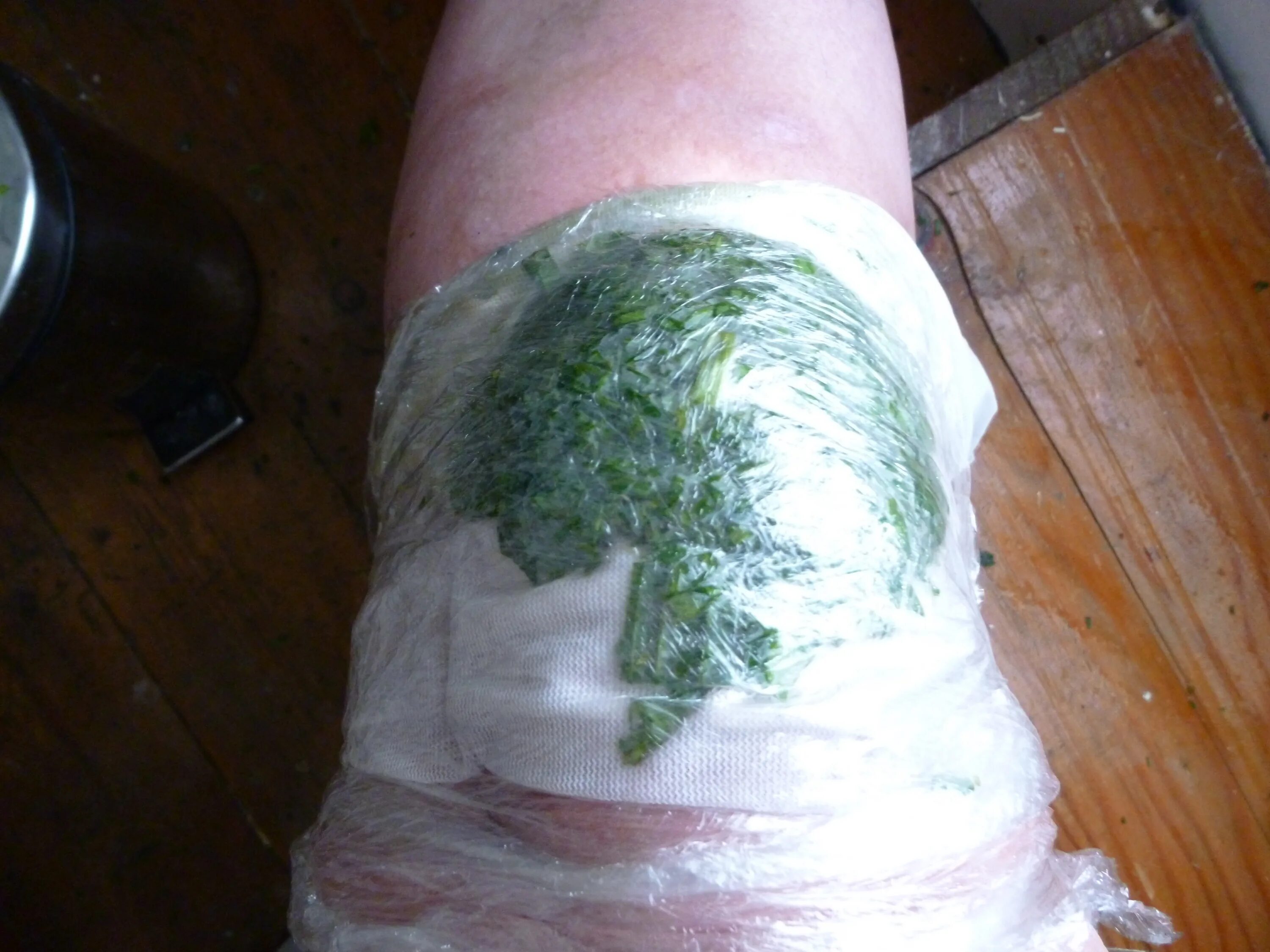 Сильная рана что делать. Компресс с капустным листом. Капустный лист для суставов колено. Компресс на коленный сустав. Компресс с листьев капусты.
