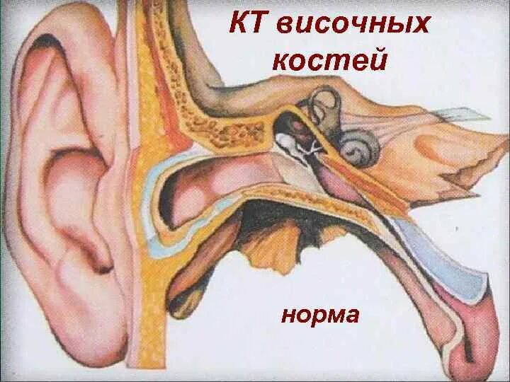 Строение кости сосцевидного отростка. Строение наружного уха. Среднее ухо слуховые косточки строение. Строение ушной раковины человека анатомия. Мастоидит сосцевидного отростка.