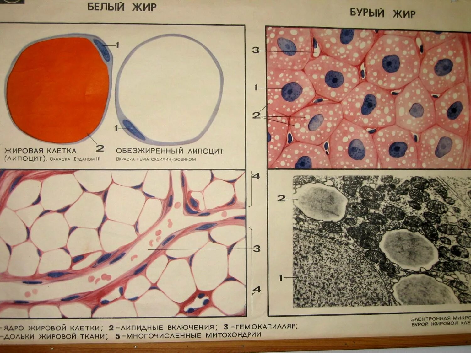 Липоциты. Клетки жировой ткани гистология. Гистология препараты жировые клетки. Белая жировая ткань гистология препарат. Белая и бурая жировая ткань гистология.