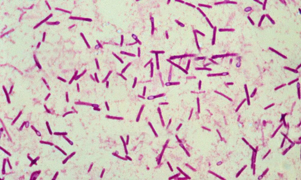 Палочки ботулизма Clostridium botulinum. Грамположительные бациллы. Клостридии.. Столбнячная палочка Clostridium tetani. Клостридии ботулизма ( Clostridium botulinum ) ботулизм.