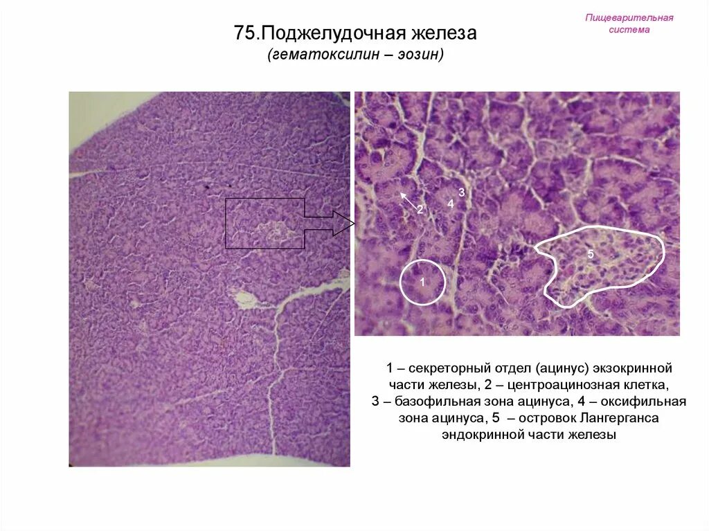 Строение поджелудочной гистология. Ацинус поджелудочной железы гистология препарат. Поджелудочная железа гистология препарат экзокринная часть. Поджелудочная железа гистология препарат.
