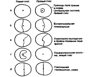 Поле дефекта