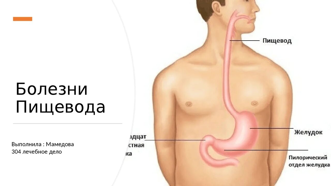 Масса пищевода. Пищевод и желудок анатомия. Где находится пищевод у человека. Где находится пищевод у человека фото. Строение пищевода и желудка.