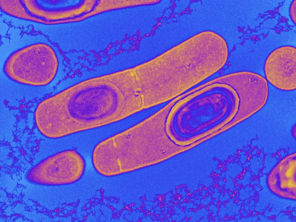 Clostridium spp. Бактерии клостридиум. Клостридии бактерии.