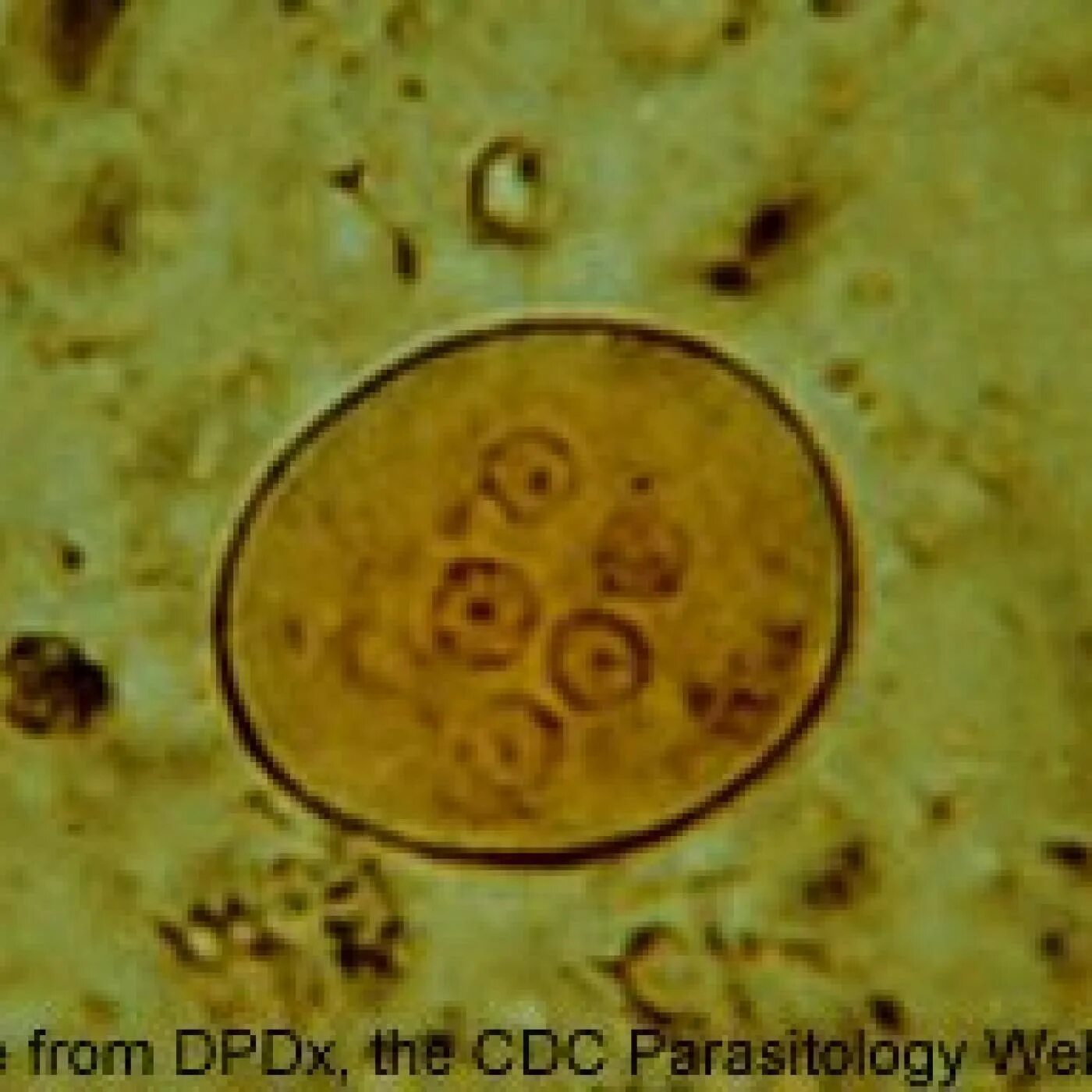 Entamoeba histolytica циста. Цисты кишечной амебы (Entamoeba coli). Микроскопия кала цисты амеба. Дизентерийная амеба в Кале.