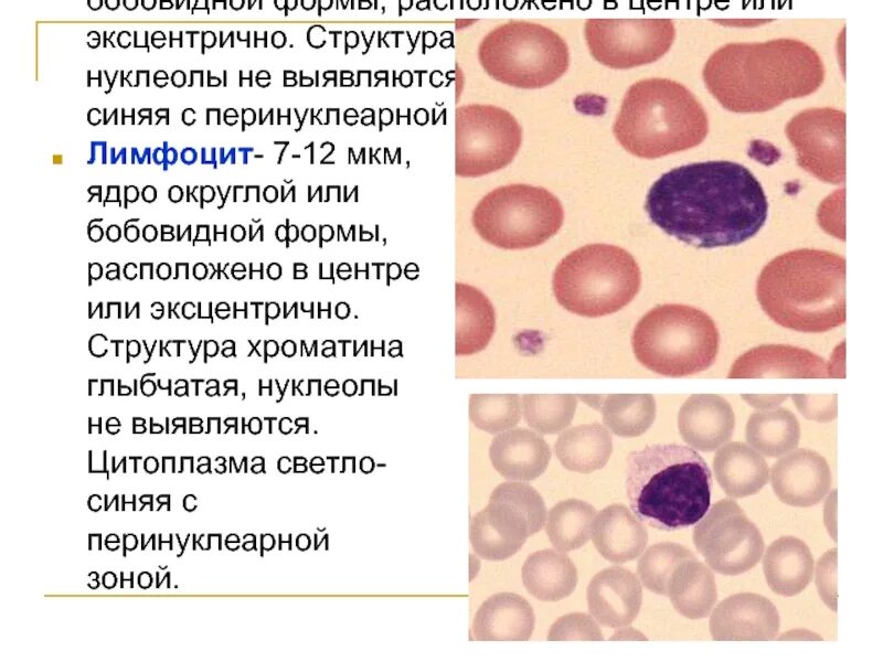 Лимфоциты в крови гистология. Лимфоциты гистология препарат. Лимфоциты ядро. Форма ядра лимфоцитов. Лимфоциты состав