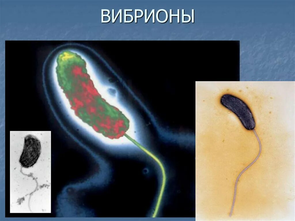 Организм трутовик окаймленный холерный вибрион. Бактерии вибрионы 5 класс. Галофильные вибрионы. Вибрионы 5 класс. Строение бактерии вибрионы.