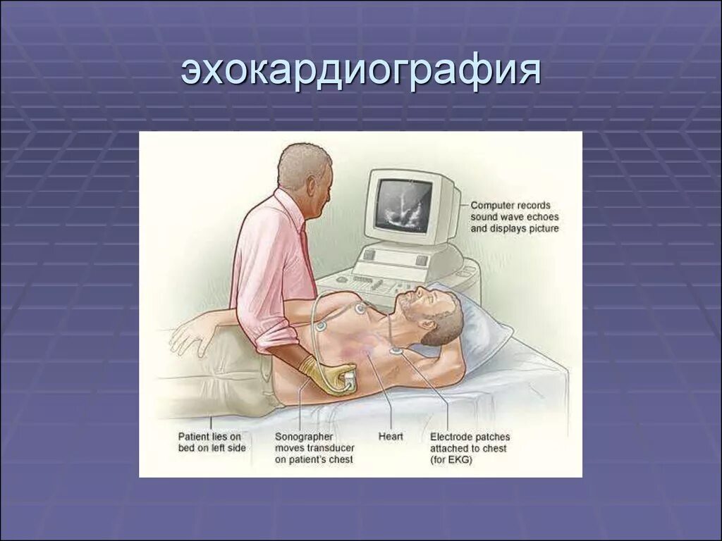 Эхо кардиография. Ультразвуковое исследование сердца методы эхокардиографии. Методика ЭХОКГ. Методика проведения эхокардиографии. ЭХОКГ презентация.