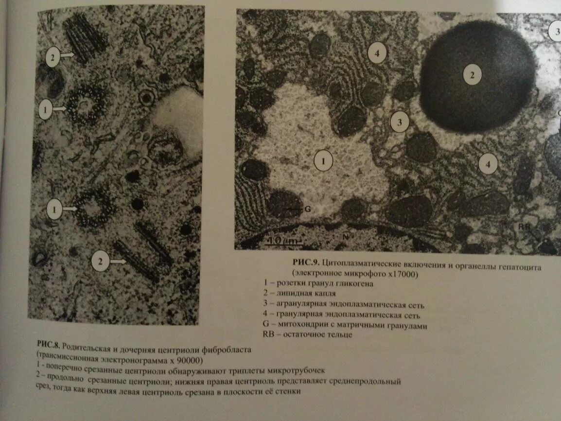 компоненты эукариотической клетки микрофото. лимфоцит электронограмма. описание микрофотографий. оптическая схема метода микрофотографии. включения электронограмма.