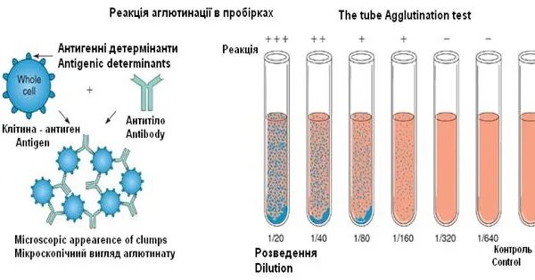 Развернутая реакция агглютинации. Реакция агглютинации видаля. реакция агглютинации микробиология. развернутая реакция агглютинации микробиология. реакции агглютинации в пробирке схема.