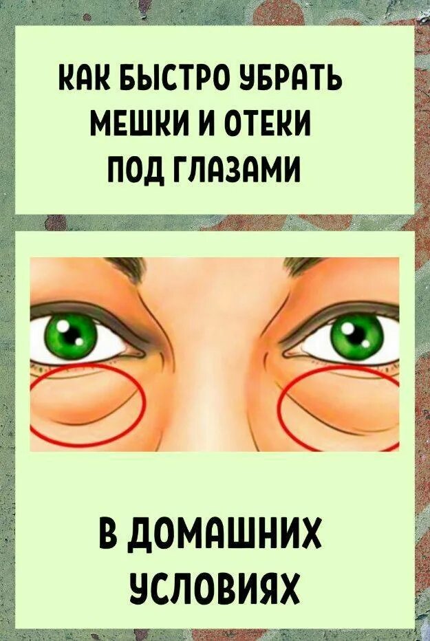 Глазами быстро и навсегда. Убирание отеков под глазами. мешки под глазами убрать быстр. убирание отеков под глазами в дом.условиях.