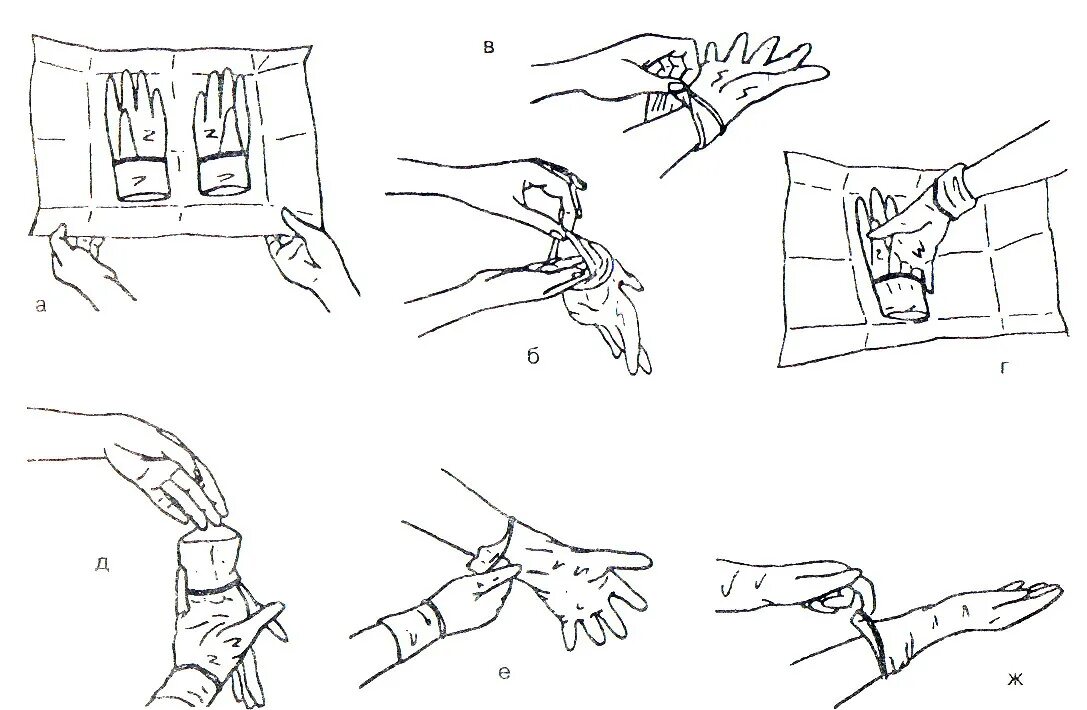 Хирургическая обработка рук медперсонала. Надевание стерильных перчаток алгоритм. Техника одевания стерильных перчаток. Одевание стерильных перчаток алгоритм. Одевание стерильных перчаток на хирурга алгоритм.