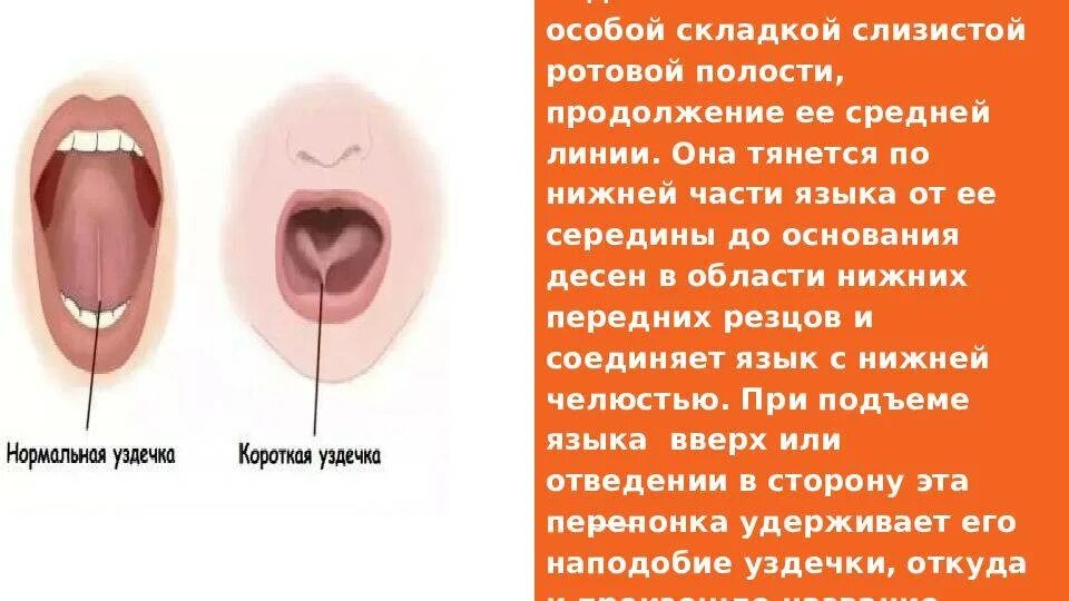 Корень языка у человека - CollectPhoto.ru