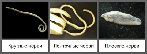 Глисты у человека какие бывают картинках