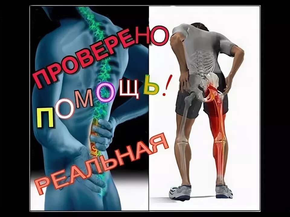 Защемление седалищного нерва симптомы отзывы. Разблокировка седалищного нерва. защемило седалищный нерв упражнения. седалищный нерв упражнения для снятия боли. упражнения при защемлении седалищного нерва в ягодице и ноге.