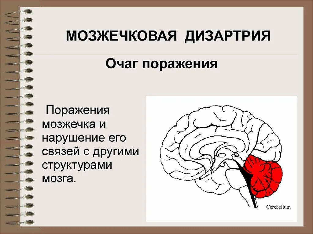 Поражения корково мозга. Мозжечковая дизартрия очаг поражения. Дизартрия при поражениях мозжечка. Мозжечковая дизартрия локализация поражения. Псевдобульбарная дизартрия очаг поражения мозга.