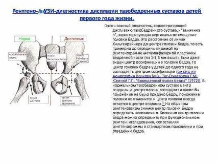 Углы тазобедренного сустава у детей