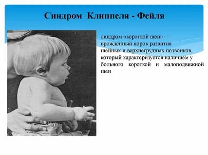 Признаки короткой