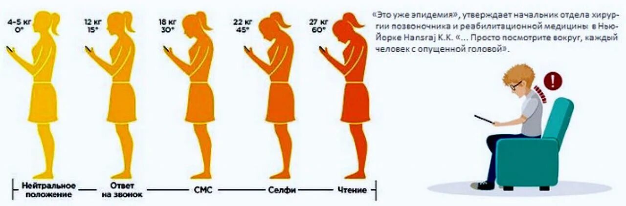 Как правильно держать голову. Нагрузка при наклоне головы. Нагрузка на шею. Нагрузка на шею при наклоне головы. Нагрузка на шейный отдел позвоночника.