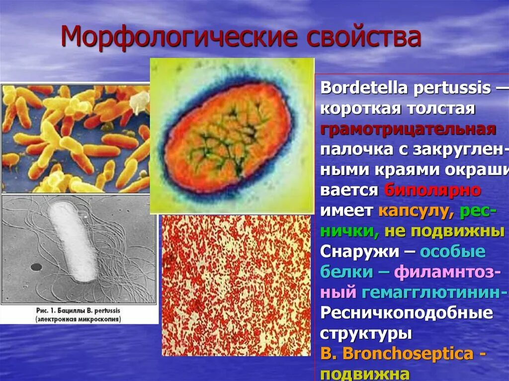 Коклюш бактериальная. Коклюш Bordetella pertussis (бордетелла пертуссис). Bordetella pertussis морфологические свойства. Коклюш строение бактерии. Адгезины Bordetella pertussis.