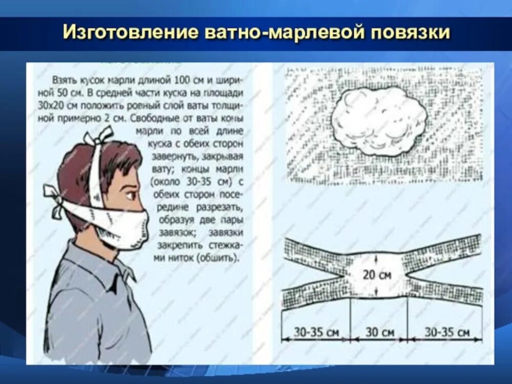 Изготовить вмп ватно-марлевую повязку. Изготовление ватно марлевой повязки инструкция. Схема изготовления ватно-марлевой повязки. Сиз ватно марлевая повязка. Памятка по изготовлению ватно-марлевых повязок.
