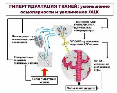 Гипергидратация