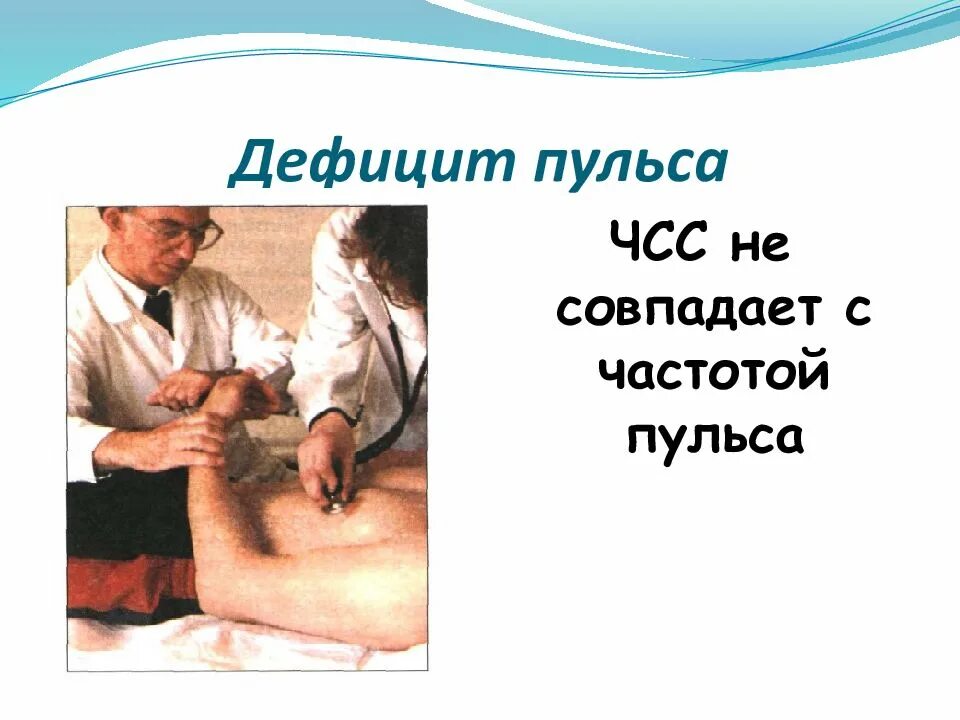 Дефицит артериального пульса. Дефицит пульса. выявление дефицита пульса. понятие о дефиците пульса. дефицит пульса определяется.