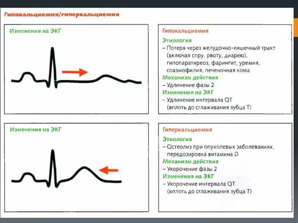 Изменения на ЭКГ при гиперкальциемии. Гипокальциемия изменения на ЭКГ. Изменение ЭКГ при гипо и гиперкалиемии. Гипокалиемия и гиперкалиемия на ЭКГ. Экг метаболические изменения что это значит