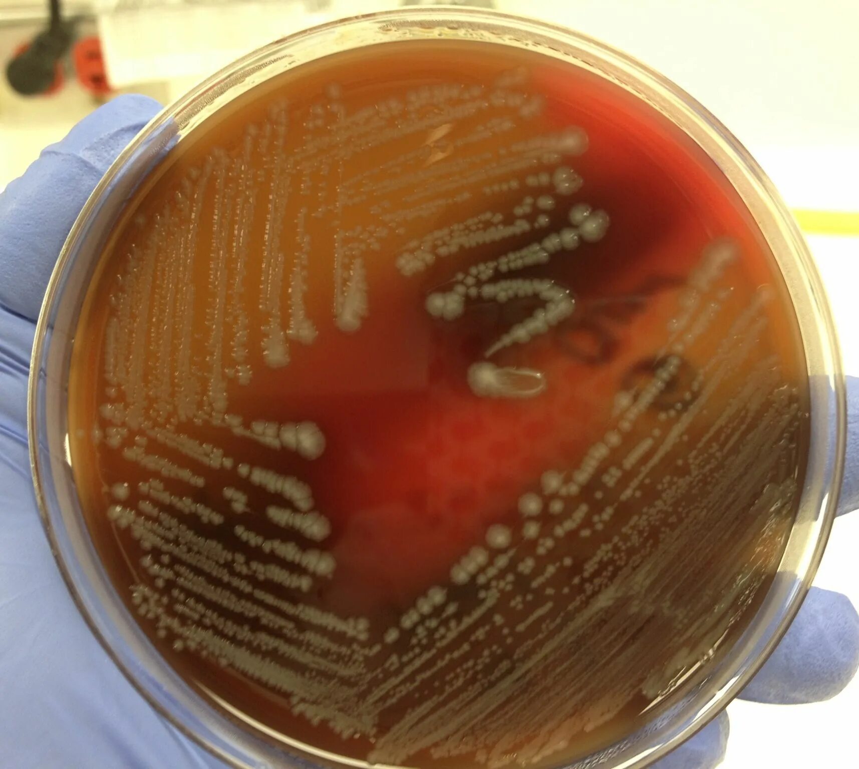 Staphylococcus e coli. E coli микробиология. шоколадный агар в микробиологии. окраска стафилококков. стафилококк золотистый в консервах.