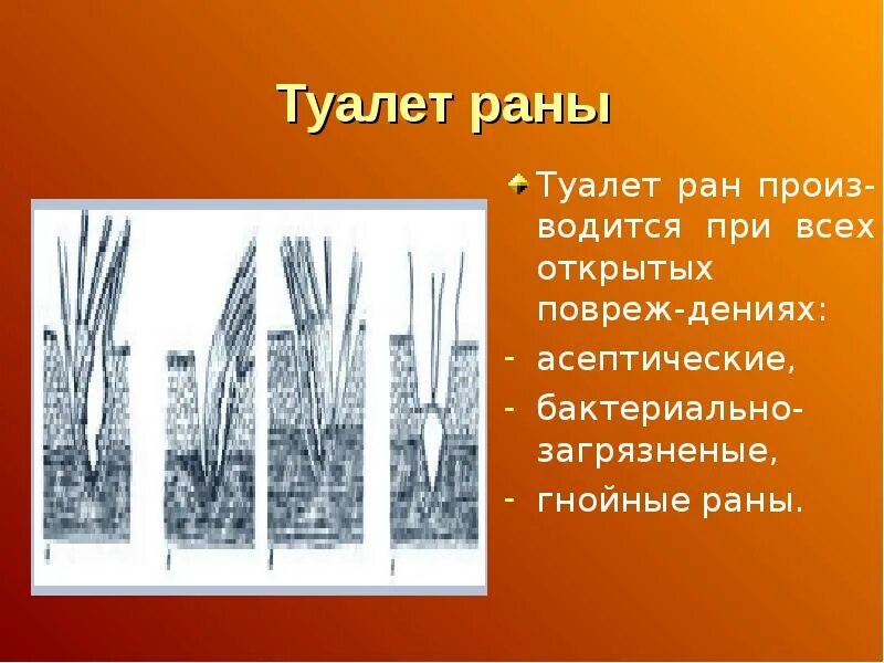Туалет ран. Туалет ран