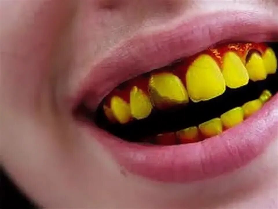 5 Penyebab Gigi Menjadi Kuning dan Cara Mengatasinya - YouTube