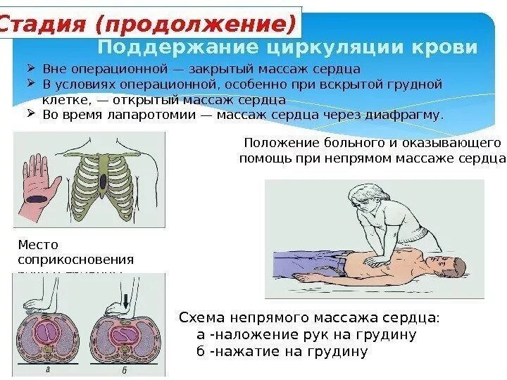 Прогиб грудины при массаже сердца. Закрытый массаж сердца. положение больного при непрямом массаже сердца. терминальные состояния реанимация. положение больного при массаже сердца.