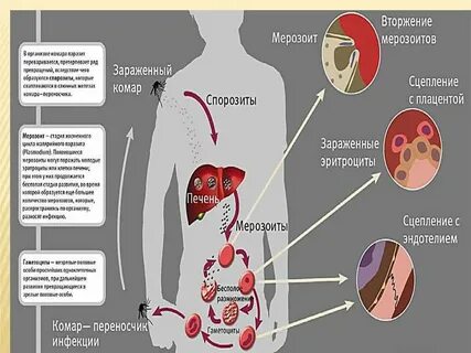 Заражение малярией