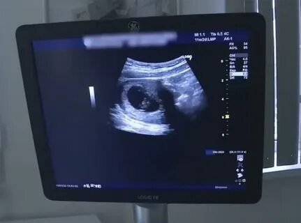 Девочка забеременела от мальчика